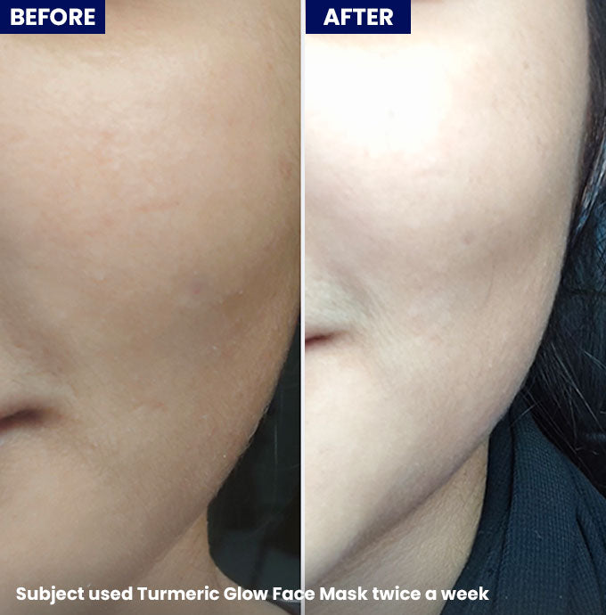 Jenpharm Turmeric Glow Face Mask