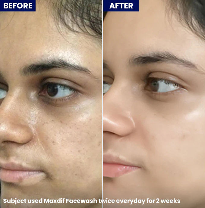 Jenpharm Maxdif Brightening Facewash