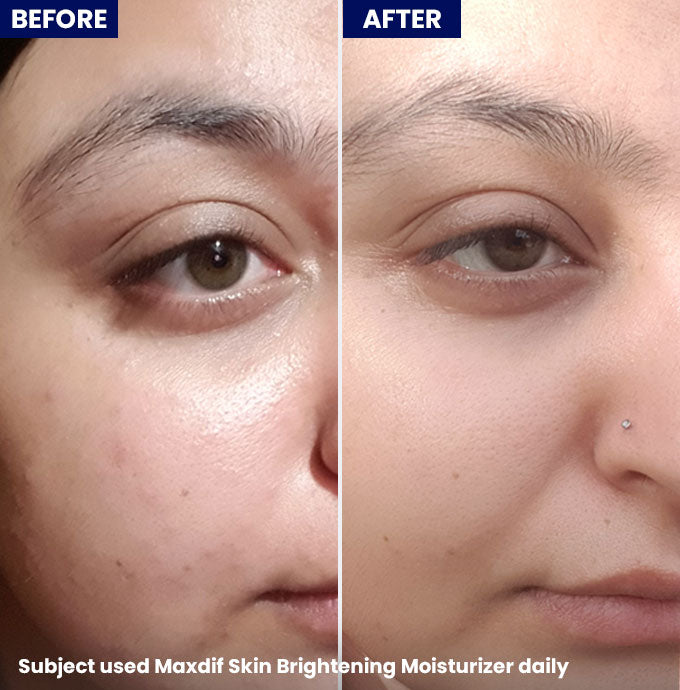 Jenpharm Maxdif Brightening Moisturizer