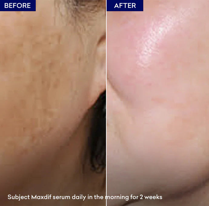 Jenpharm Maxdif Skin Brightening Serum