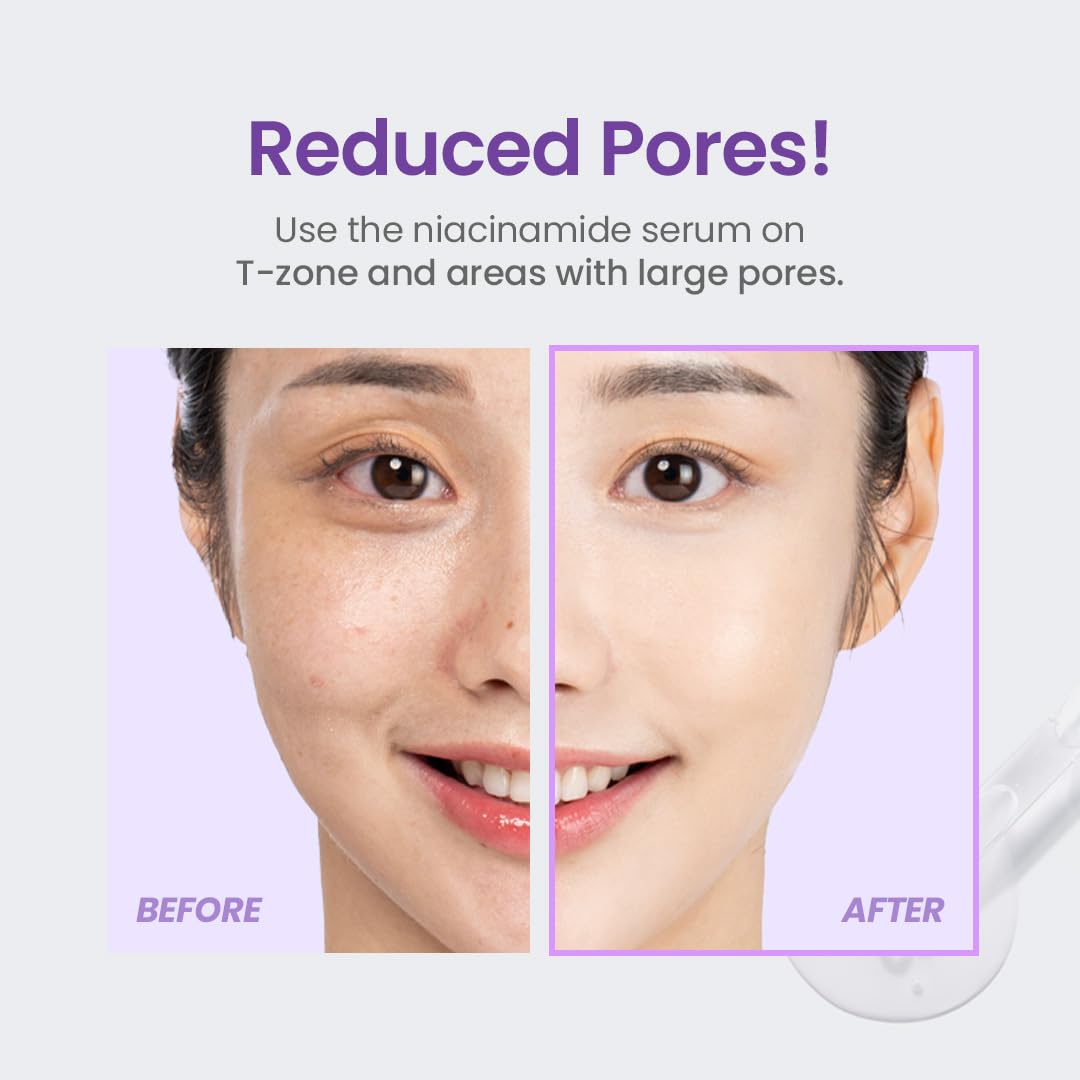 Tirtir Niacinamide 20% Serum