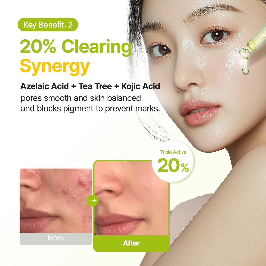 Purito Azelaic Acid 10 Kojic Tea Tree Serum