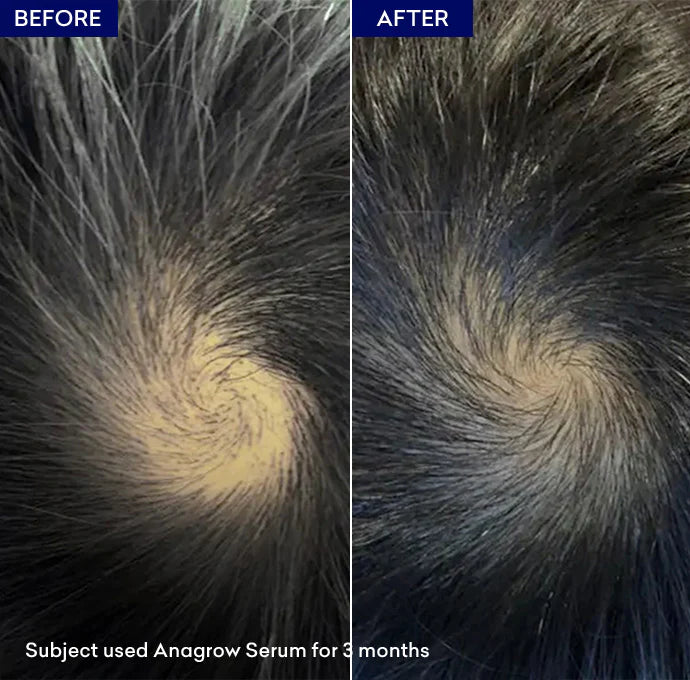 Jenpharm Anagrow Hair Serum