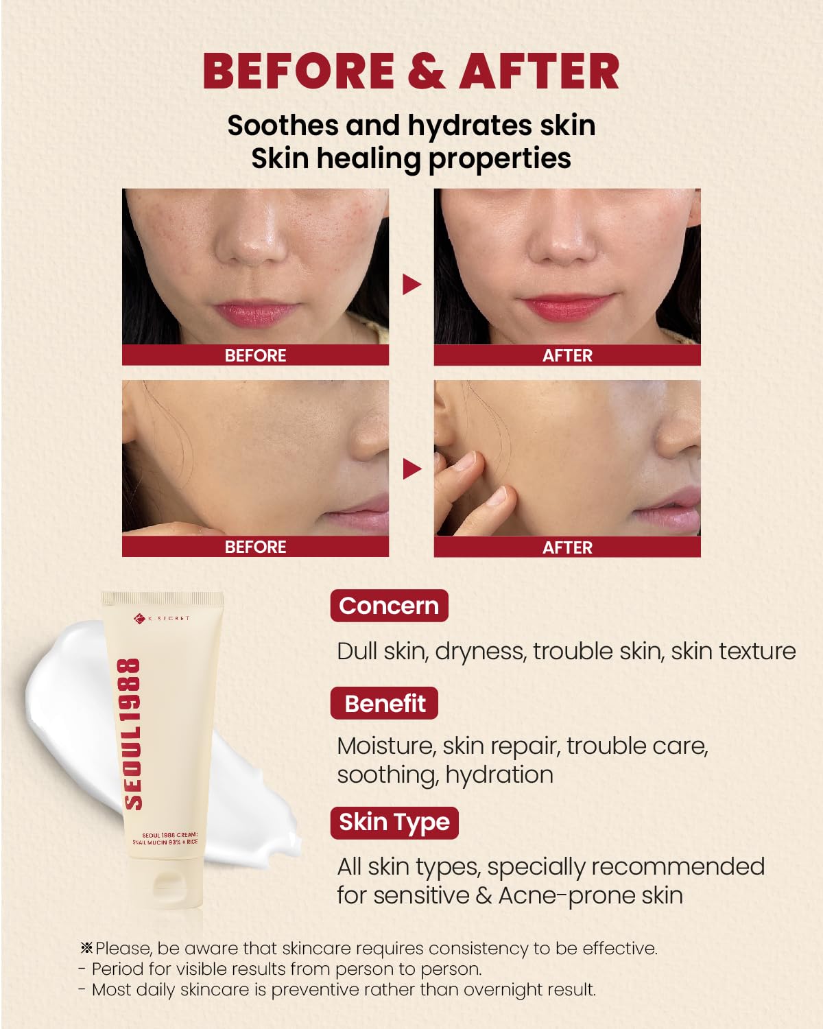 K-Secret Seoul 1988 Snail Mucin 93% + Rice Cream