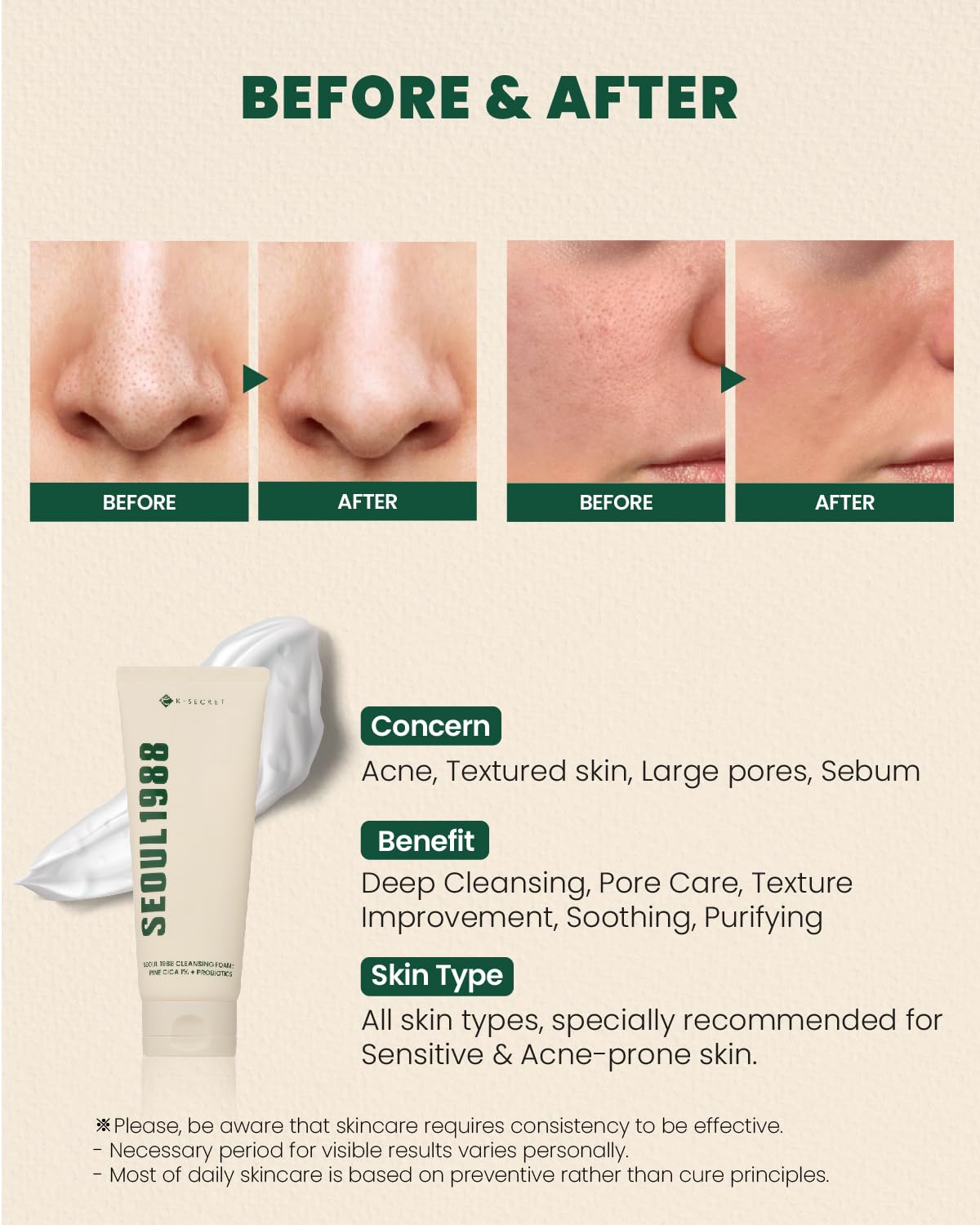 K-Secret Seoul 1988 Pine Cica 1% + Probiotics Cleansing Foam