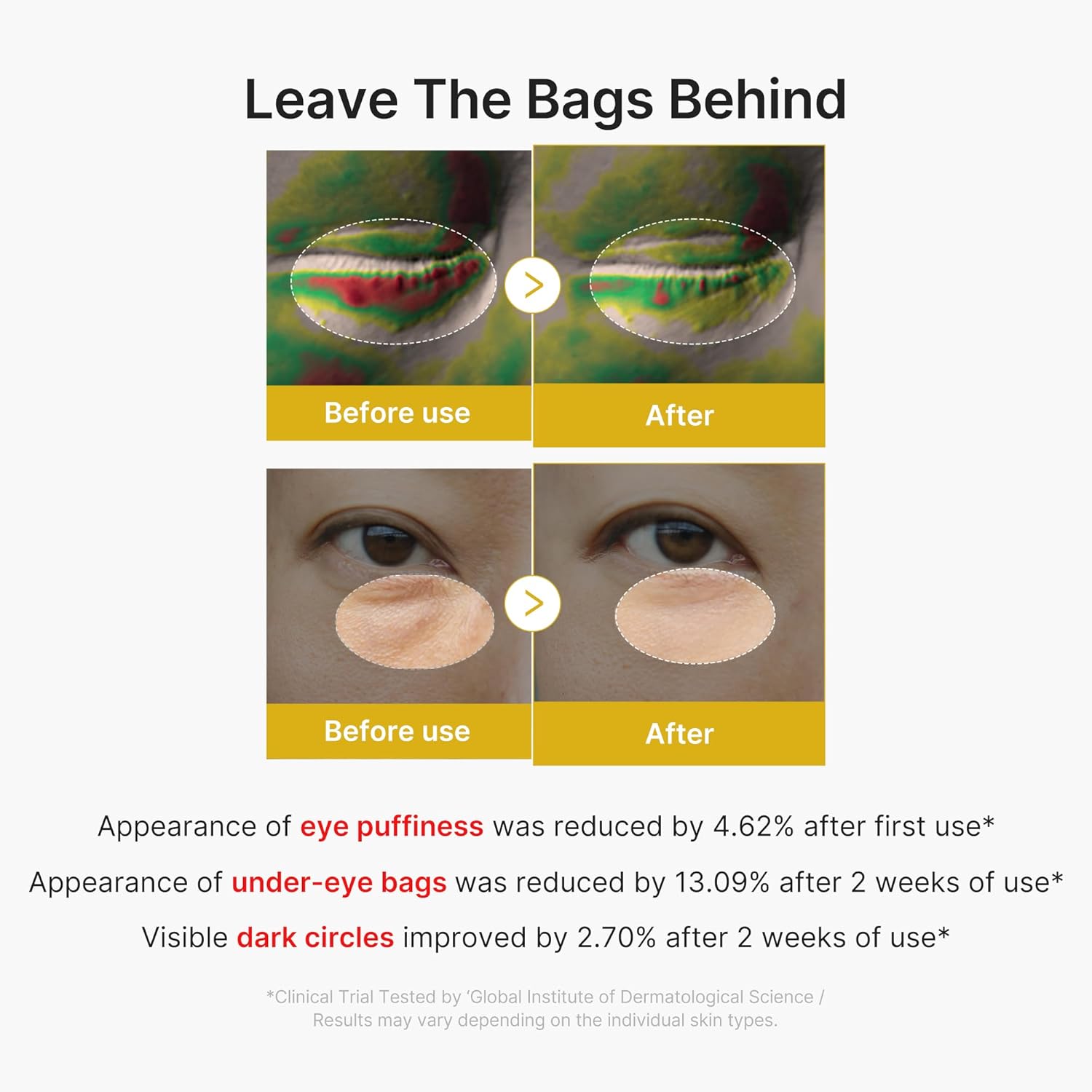 Medicube Kojic Acid Turmeric Vita Eye Gel Serum