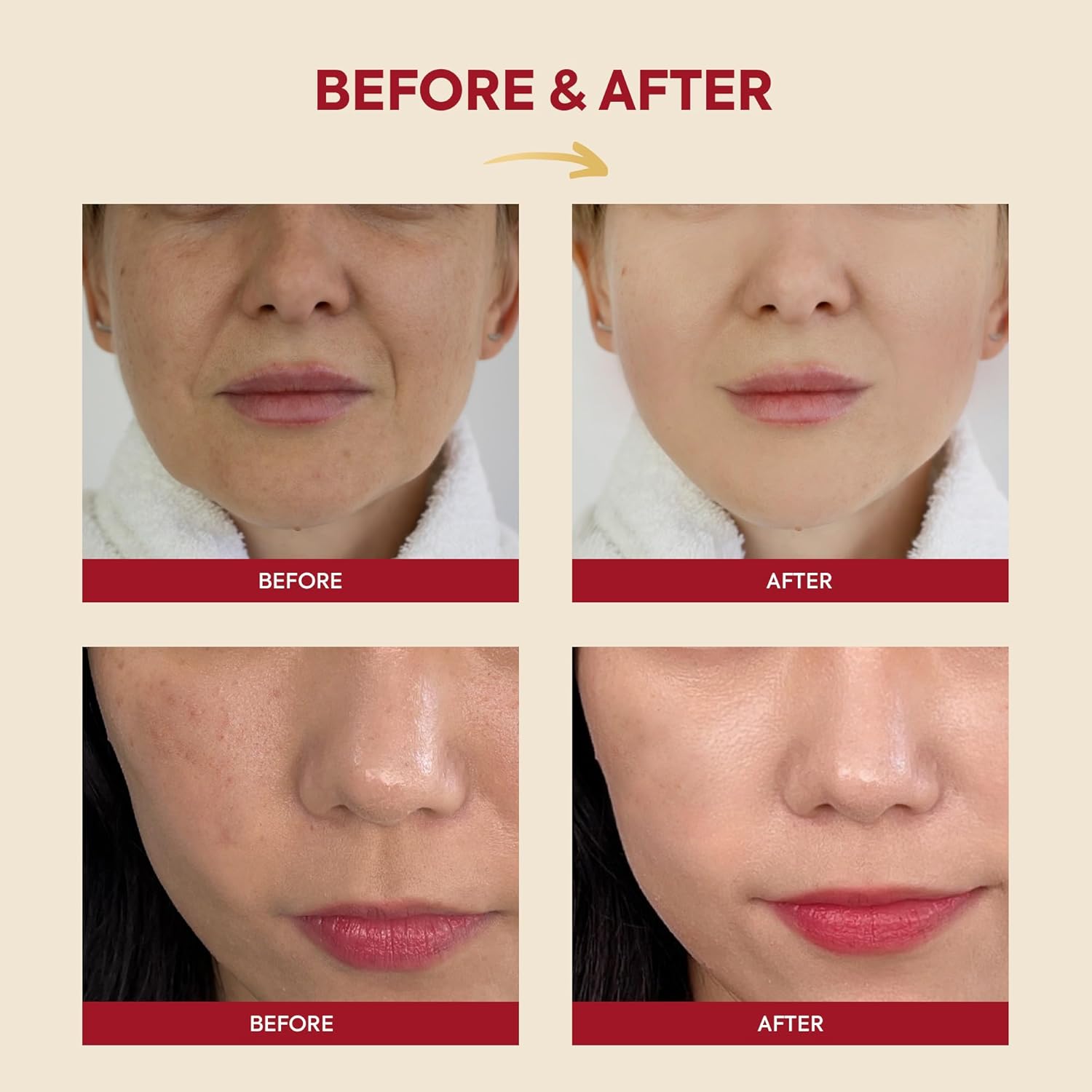 K-Secret Seoul 1988 Snail Mucin Essence 97% + Rice