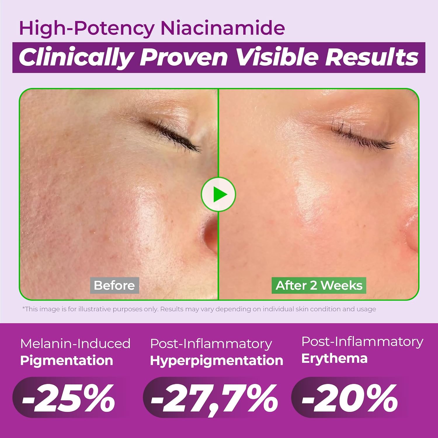Jumiso Niacinamide 20 Serum Dark Spot & Uneven Tone Care