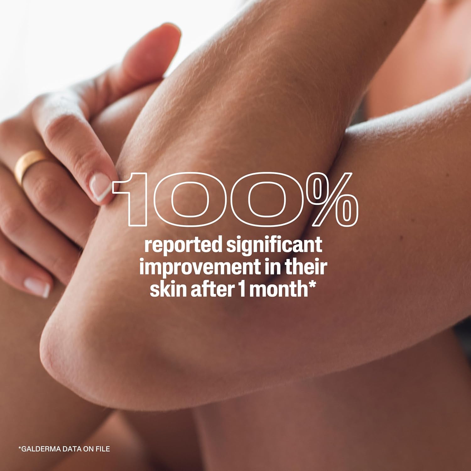 Cetaphil Urea 10 Healing Lotion