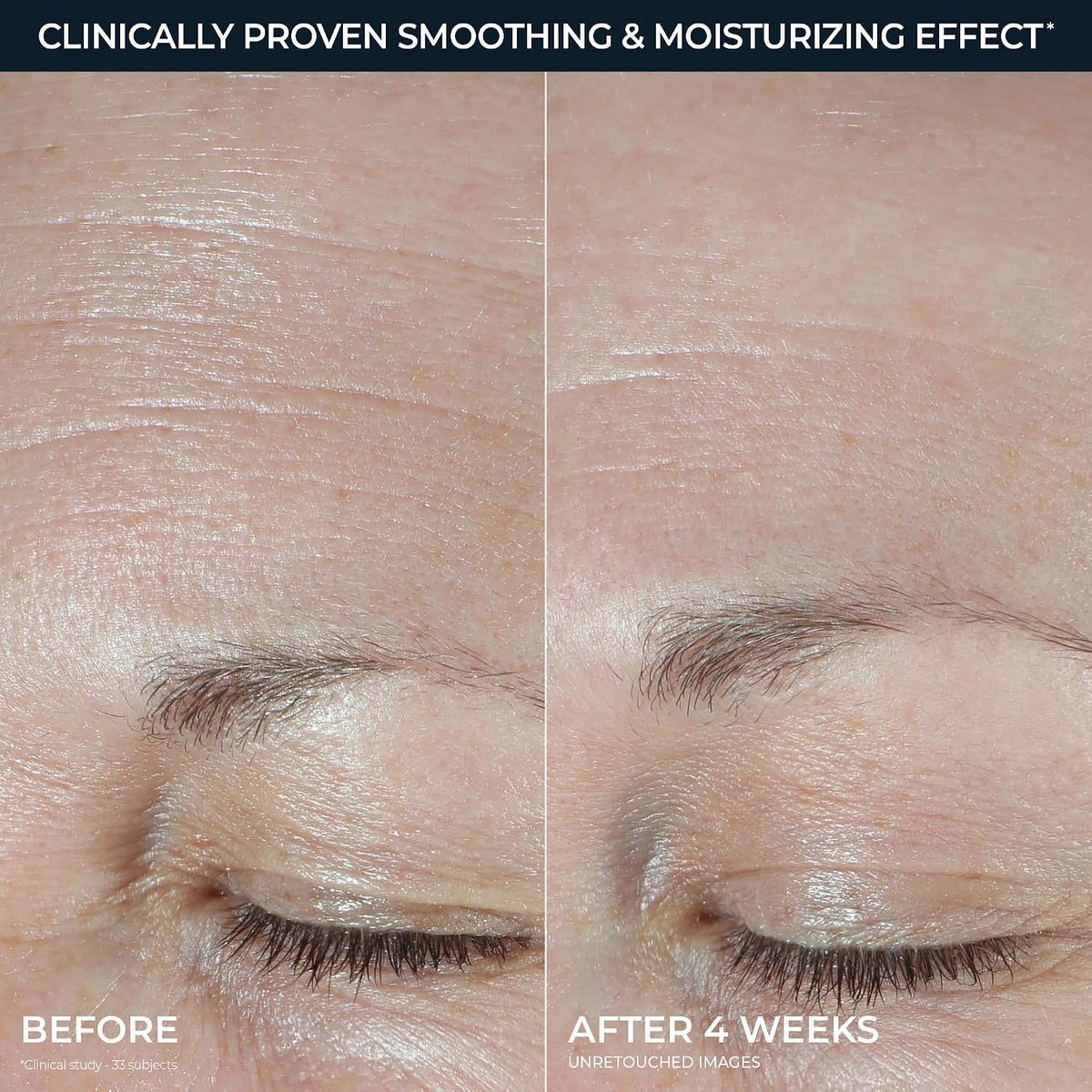 RoC Skincare Hydration+ Moisturizer