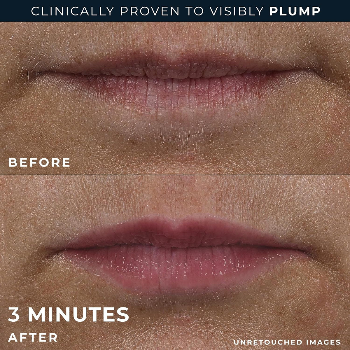RoC Derm Correxion Lip Volumizer Treatment