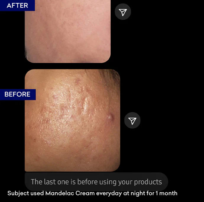 Jenpharm Mandelac Exfoliating Night Cream