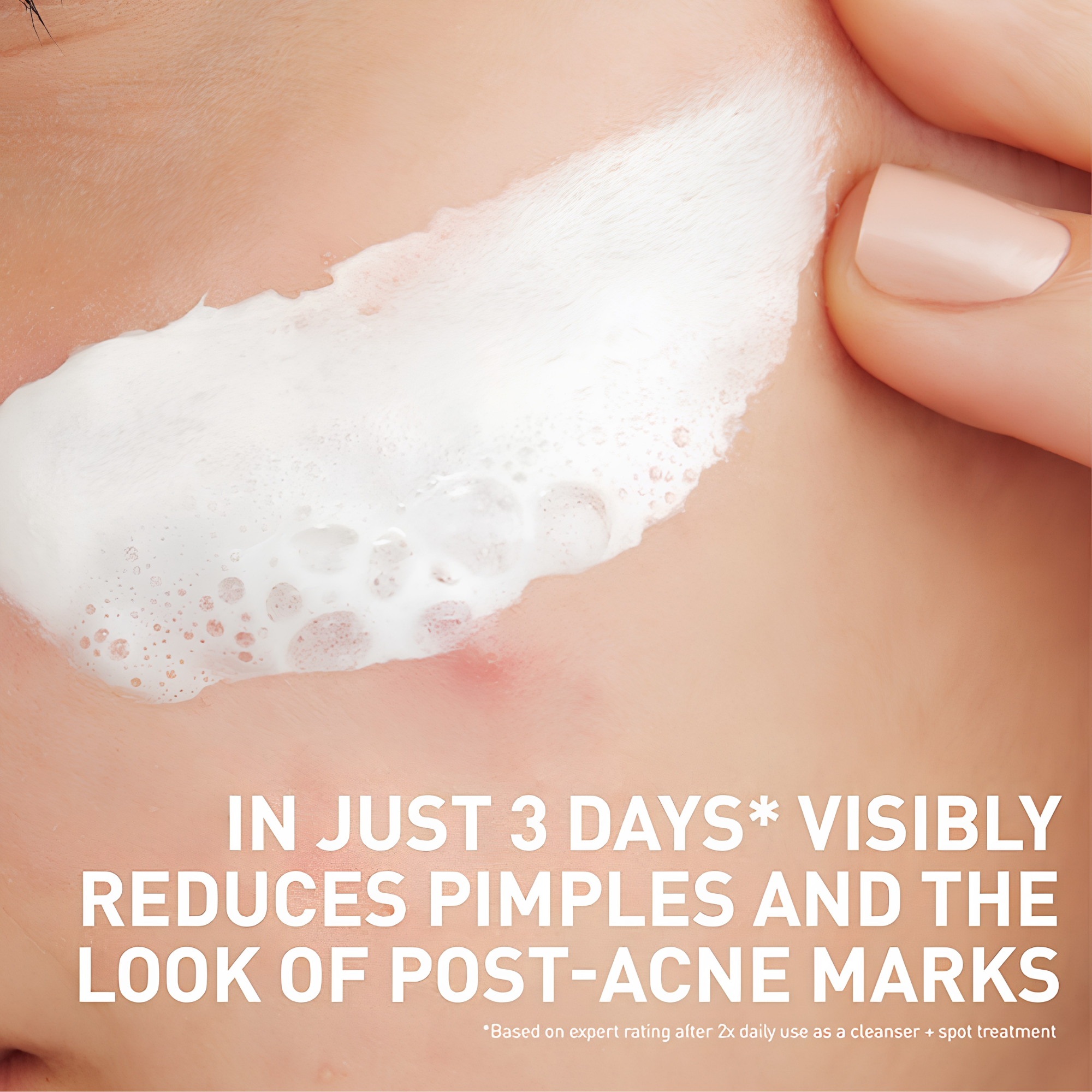 Cerave Acne Clay-to-Foam Cleanser