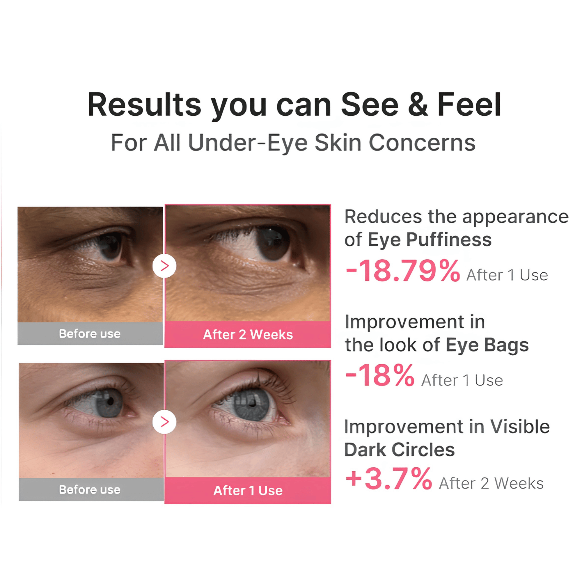 Medicube PDRN Pink Caffeine Collagen Eye Patch