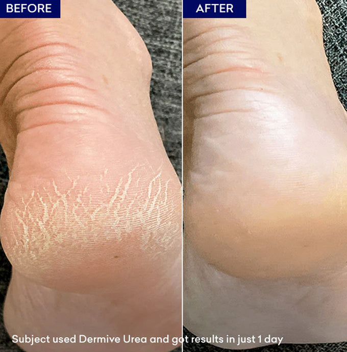 Jenpharm Dermive Urea Hydrating Healing Lotion