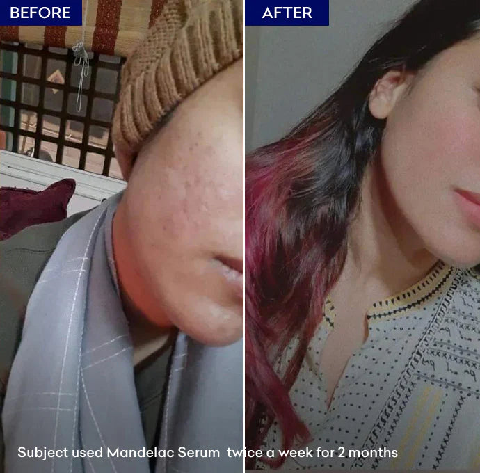 Jenpharm Mandelac Serum
