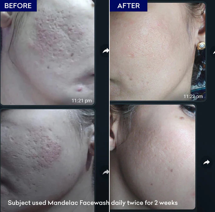 Jenpharm Mandelac Facewash