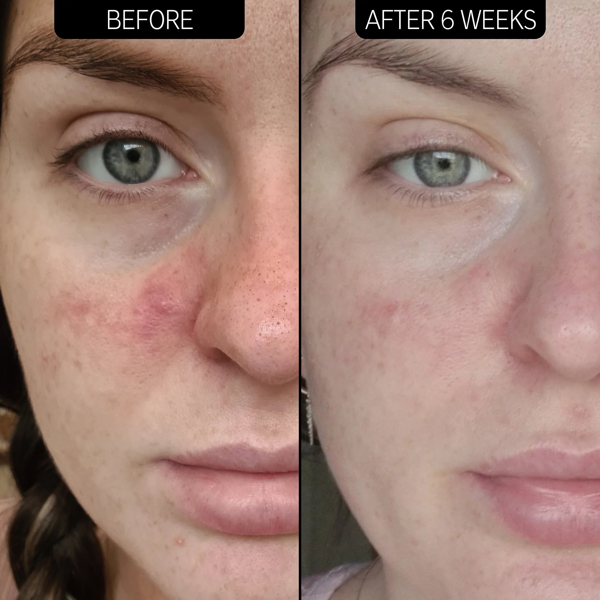 The Inkey List Redness Relief 10% Azelaic Acid Serum