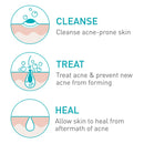 CeraVe Acne Foaming Cream Cleanser