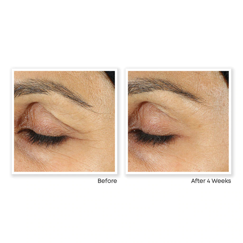 RoC Retinol Correxion® Line Smoothing Eye Cream