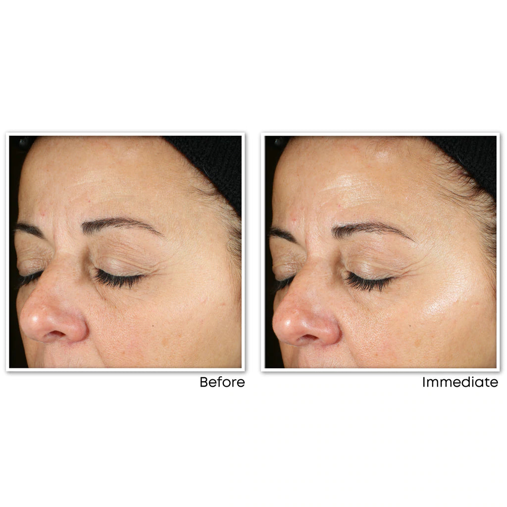 RoC Multi Correxion® Revive And Glow Daily Serum