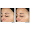 RoC Multi Correxion® Revive And Glow Daily Serum