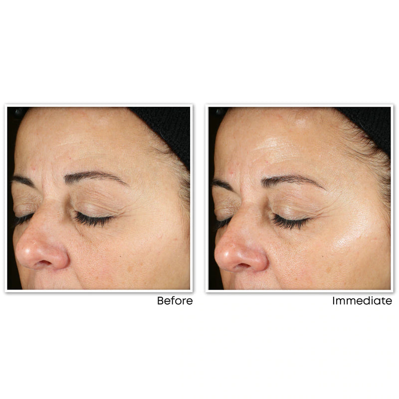 RoC Multi Correxion® Revive And Glow Daily Serum